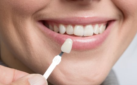 Choosing the Right Dental Implant Supplies for Successful Outcomes