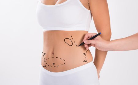 Mini Tummy Tuck in Dubai: A Less Invasive Approach to Body Contouring