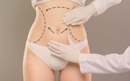 Tummy Tuck Surgery in Dubai: What You Need to Know Before the Procedure