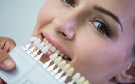 Understanding Dental Bridges: What to Expect and Why You Need One