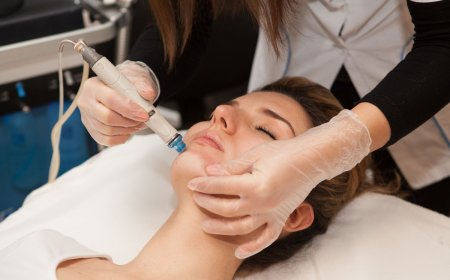 Can HydraFacial help with acne?