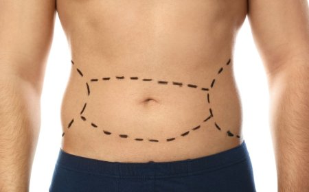 Is a Mini Tummy Tuck in Dubai the Right Choice for You?