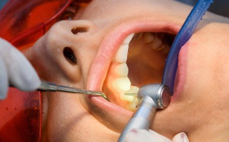 Signs You Might Need a Root Canal Treatment