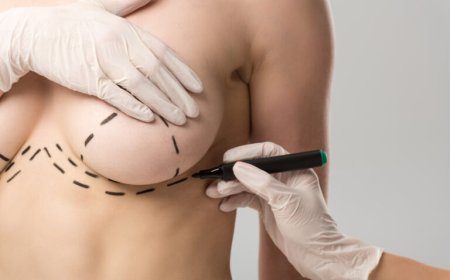 Myths and Facts About Breast Reduction in Dubai