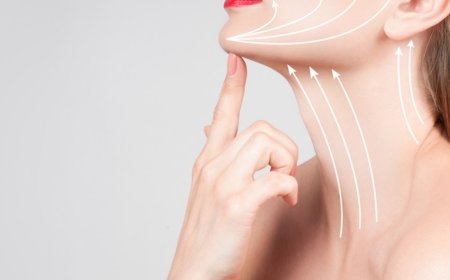 Does Neck Lift Surgery Leave Scars?