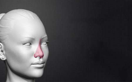 Why Is Rhinoplasty Surgery Popular Among Transgenders?