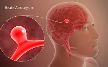 Brain Aneurysm Treatment India: 2025 Symptoms & Costs