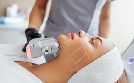 Top 5 Benefits of HIFU Therapy for Face in Islamabad