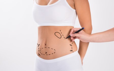 Transforming Your Confidence with Abdominoplasty in Islamabad