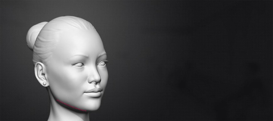Why Jawline Surgery Is Common Among Transgenders?
