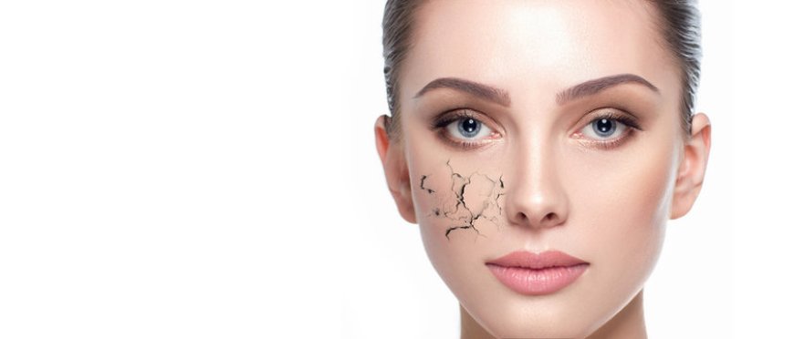 Can laser treatments help improve dry skin?