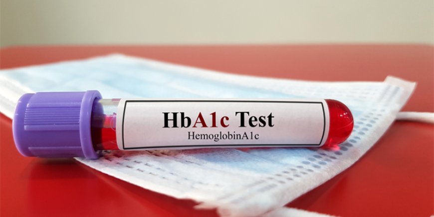 Understanding HbA1c Test Price: What You Need to Know Before Booking