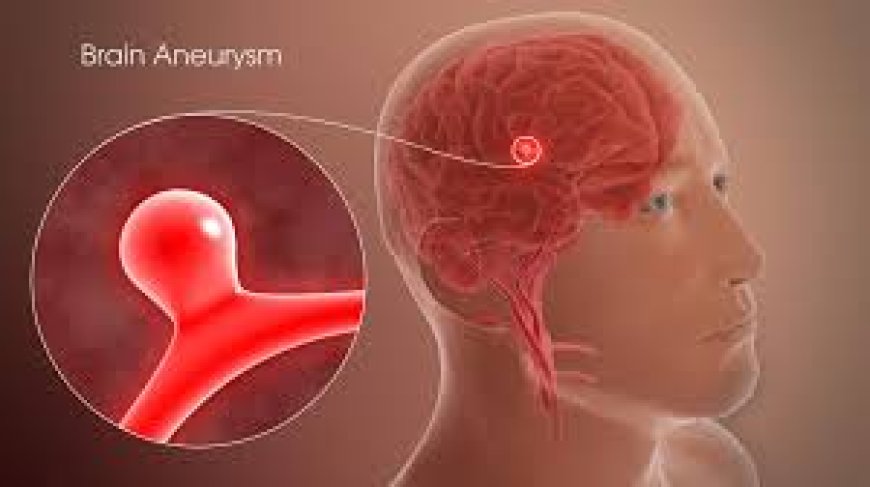 Brain Aneurysm Treatment India: 2025 Symptoms & Costs